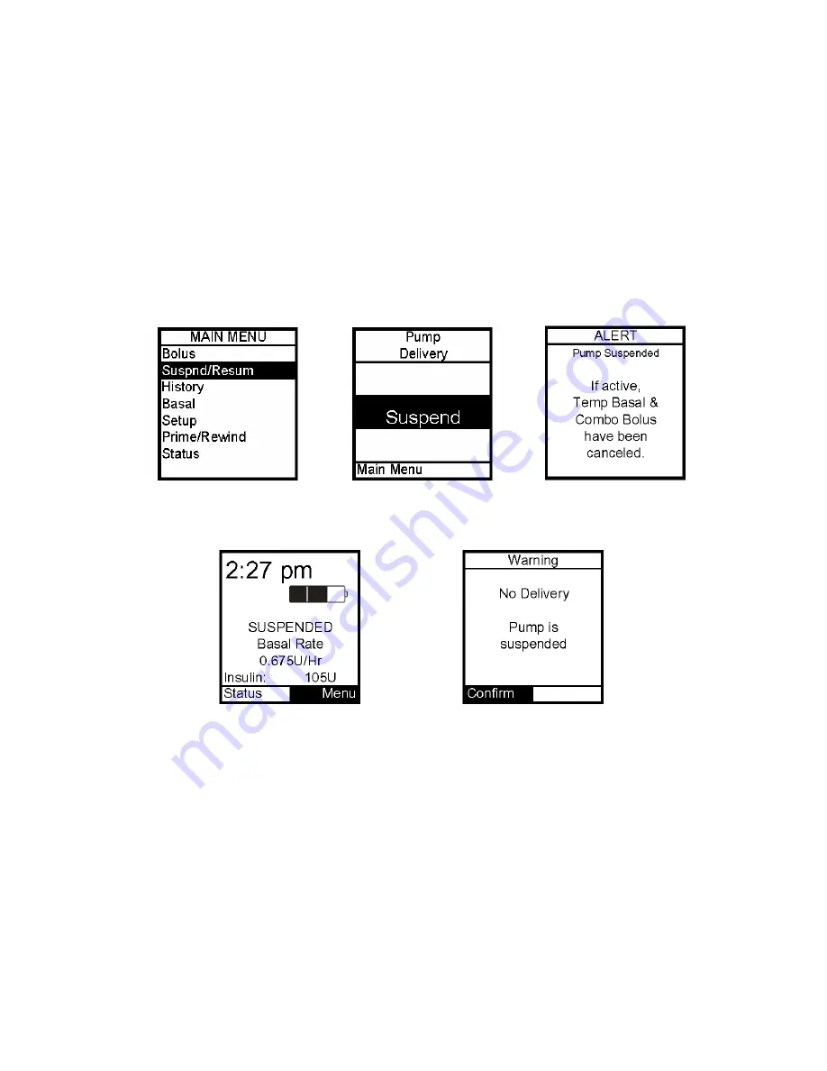 Animas IR 1200 User Manual Download Page 41