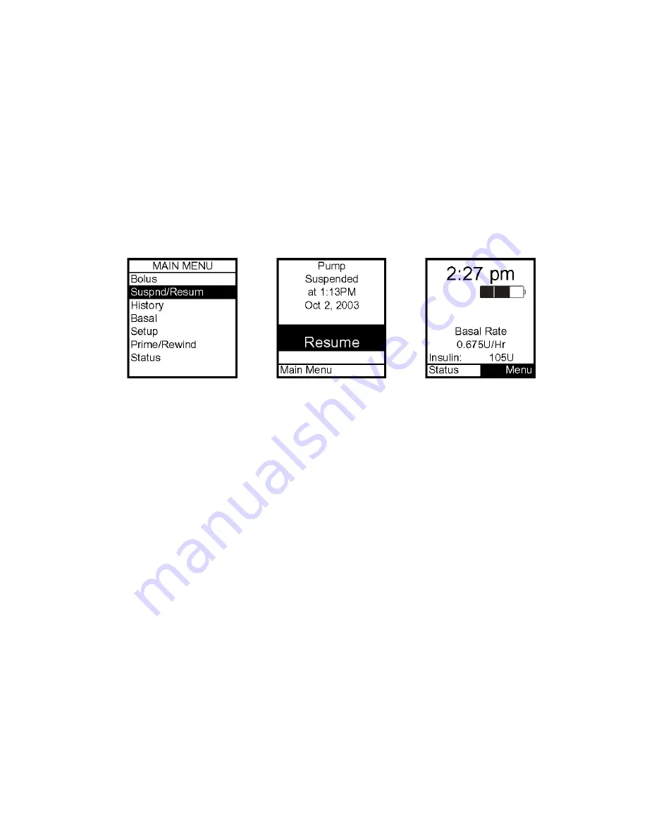 Animas IR 1200 User Manual Download Page 42