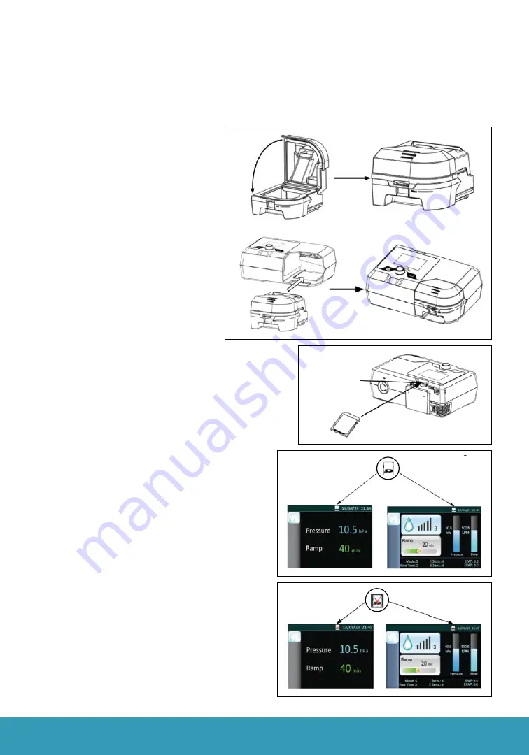 Apria Healthcare 3B Medical Luna II User Manual Download Page 5