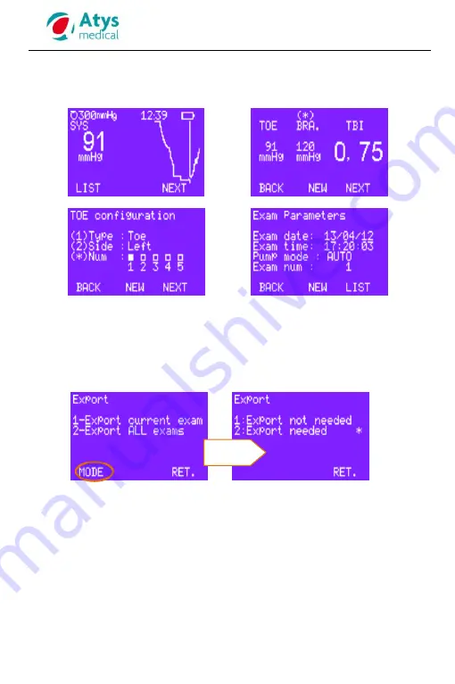 ATYS MEDICAL SysToe User Manual Download Page 23