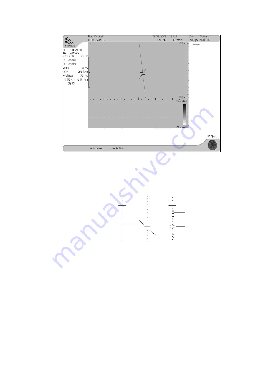 B-K Medical Pro Focus 2202 User Manual Download Page 154