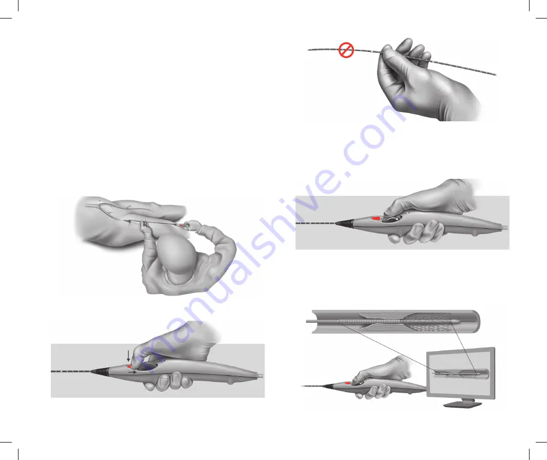 Bard Peripheral Vascular LifeStent 5F Скачать руководство пользователя страница 51