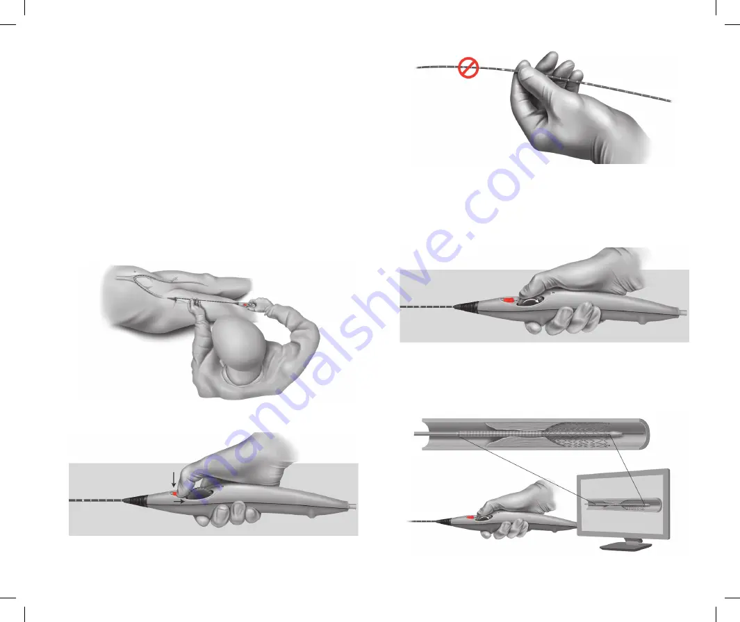 Bard Peripheral Vascular LifeStent 5F Скачать руководство пользователя страница 84