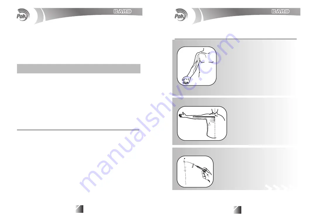 Bard Poly Per-Q-Cath Скачать руководство пользователя страница 4