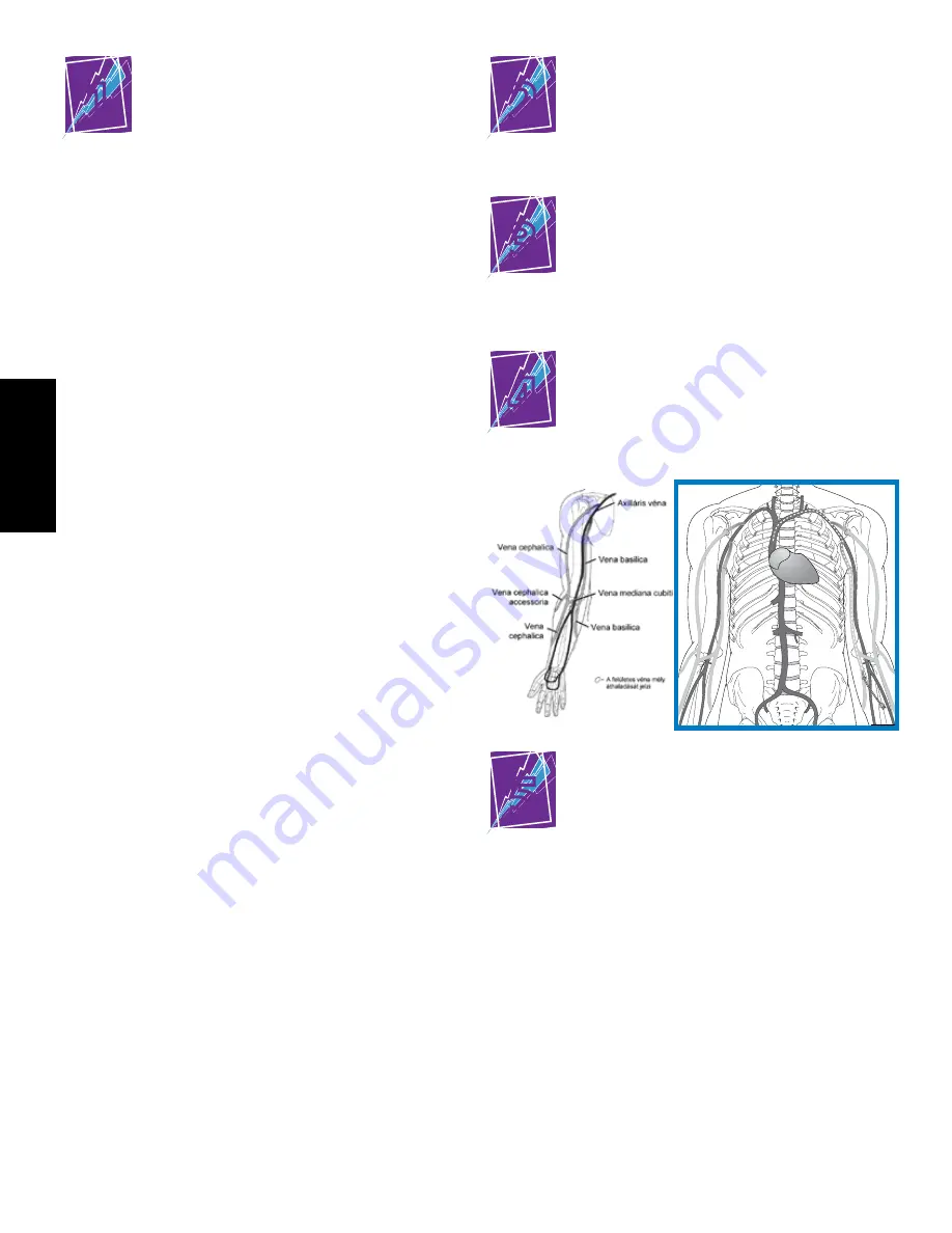 Bard PowerPICC SOLO 2 Patient Manual Download Page 58