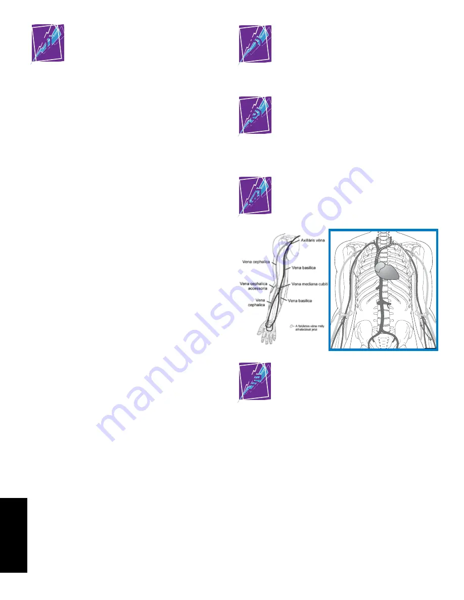 Bard PowerPICC SOLO 2 Patient Manual Download Page 82