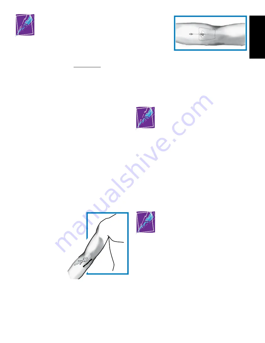 Bard PowerPICC SOLO 2 Patient Manual Download Page 89