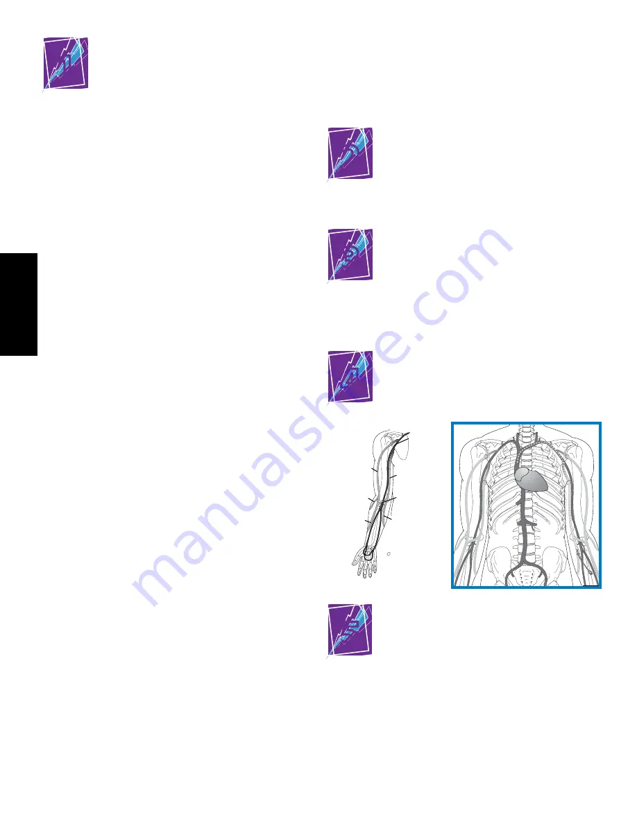 Bard PowerPICC SOLO 2 Patient Manual Download Page 100