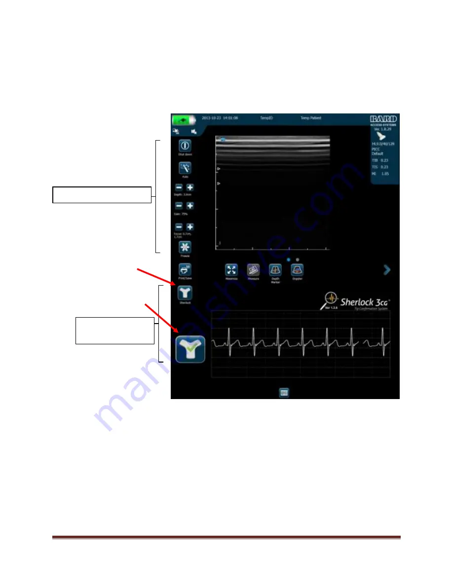 Bard Sherlock 3CG Tip Confirmation System Instructions For Use Manual Download Page 16