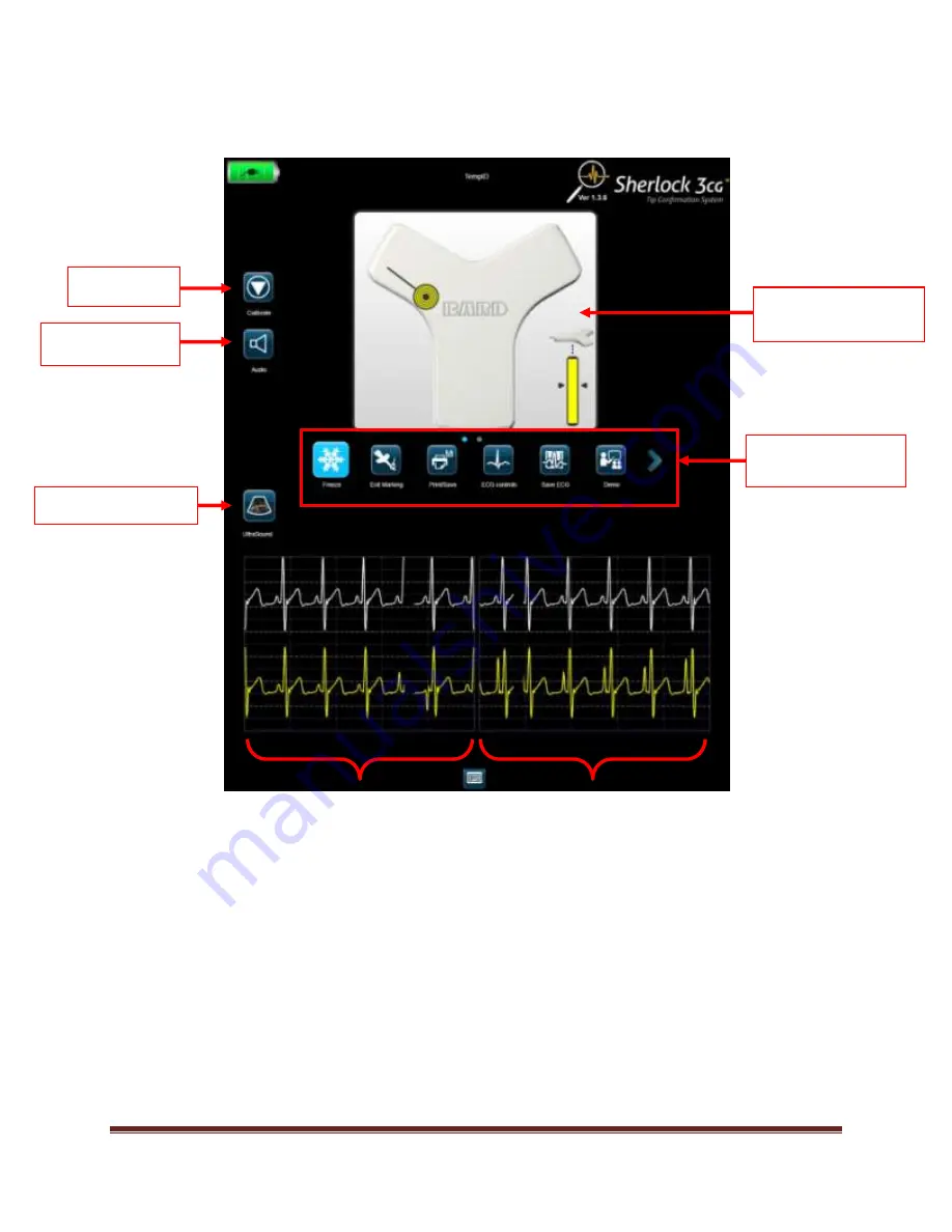 Bard Sherlock 3CG Tip Confirmation System Скачать руководство пользователя страница 17