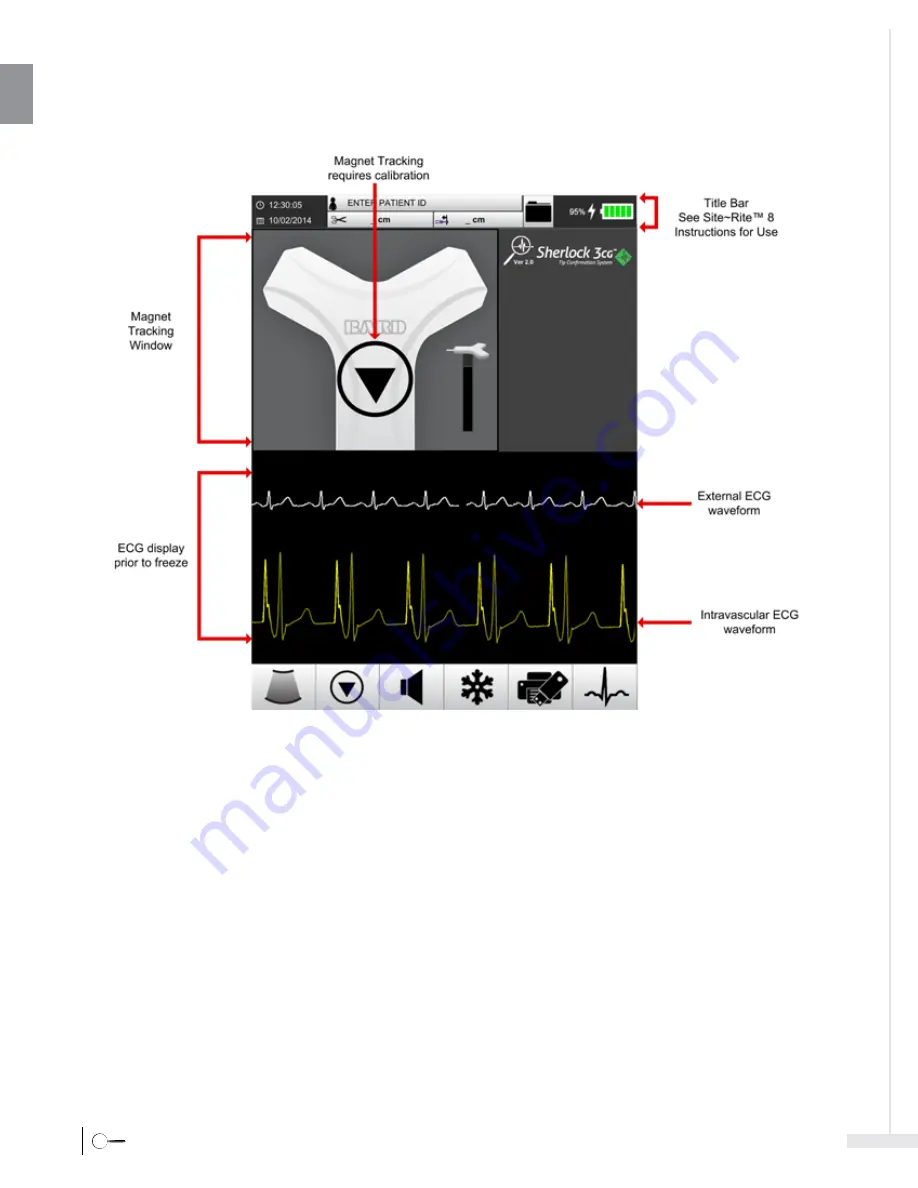 Bard Sherlock 3CG Instructions For Use Manual Download Page 10