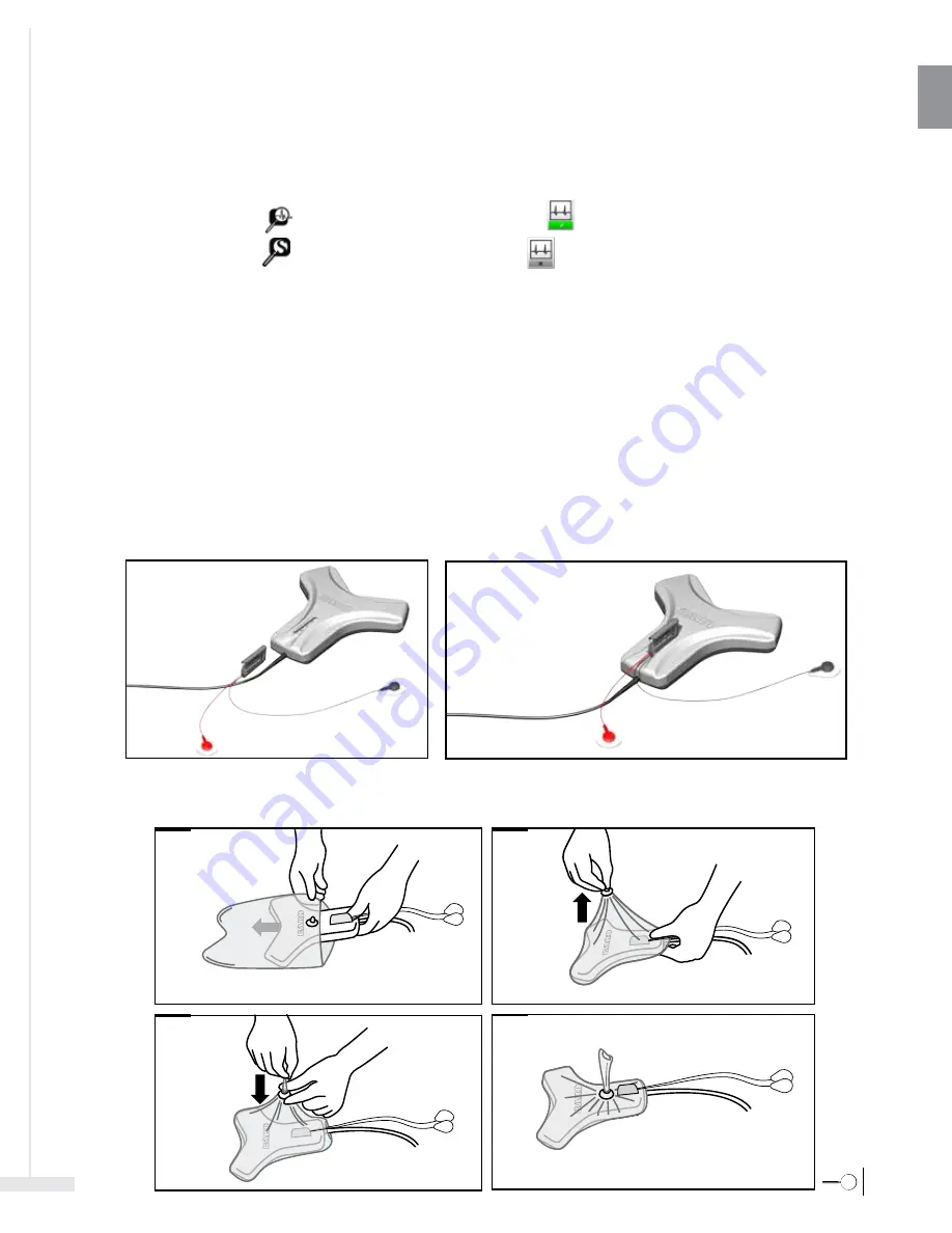 Bard Sherlock 3CG Instructions For Use Manual Download Page 17