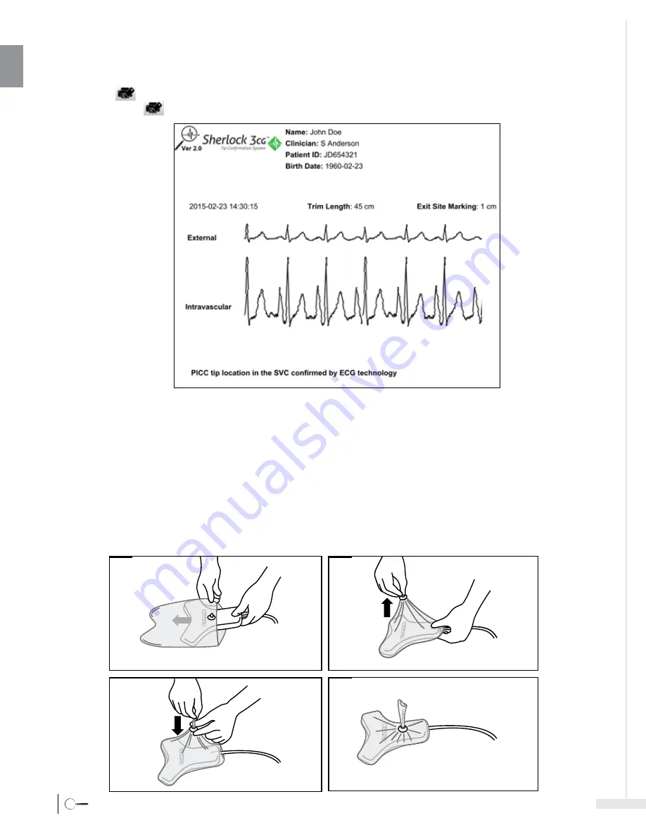 Bard Sherlock 3CG Instructions For Use Manual Download Page 20