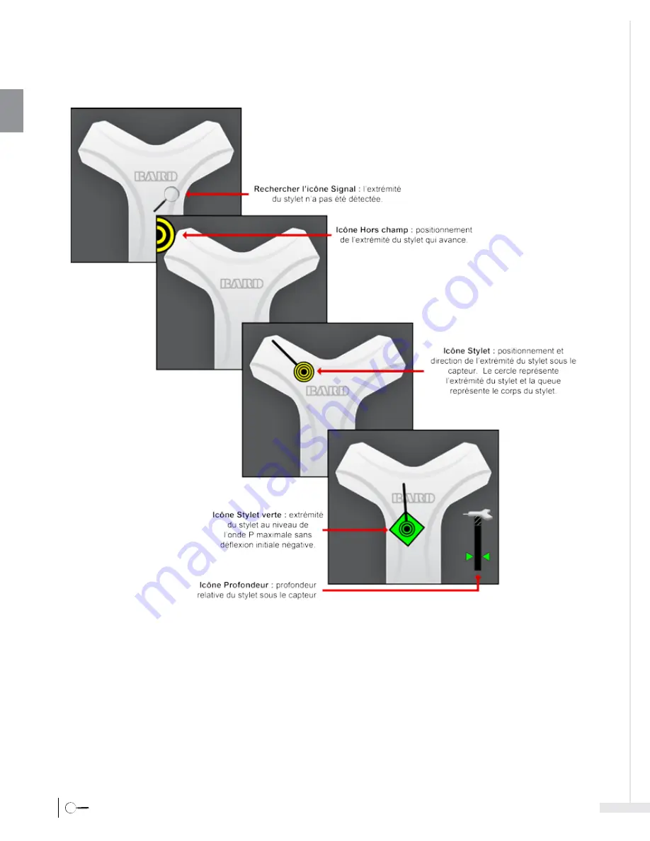 Bard Sherlock 3CG Instructions For Use Manual Download Page 38