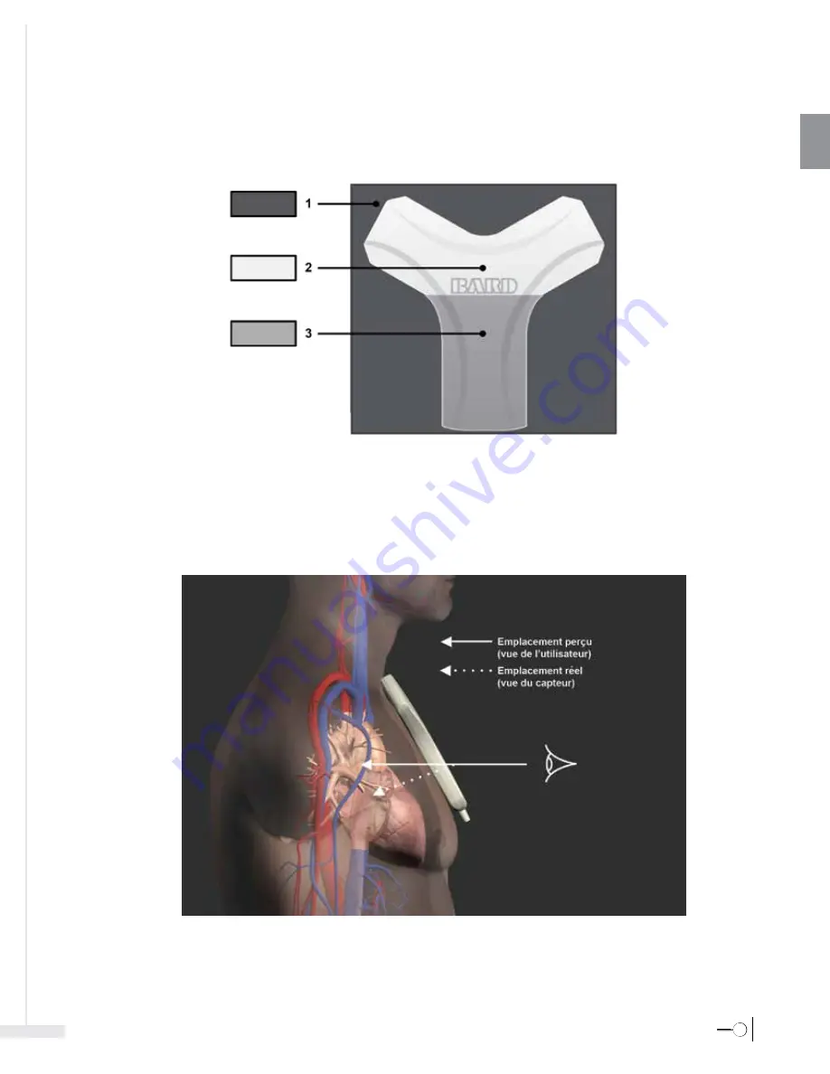 Bard Sherlock 3CG Instructions For Use Manual Download Page 43