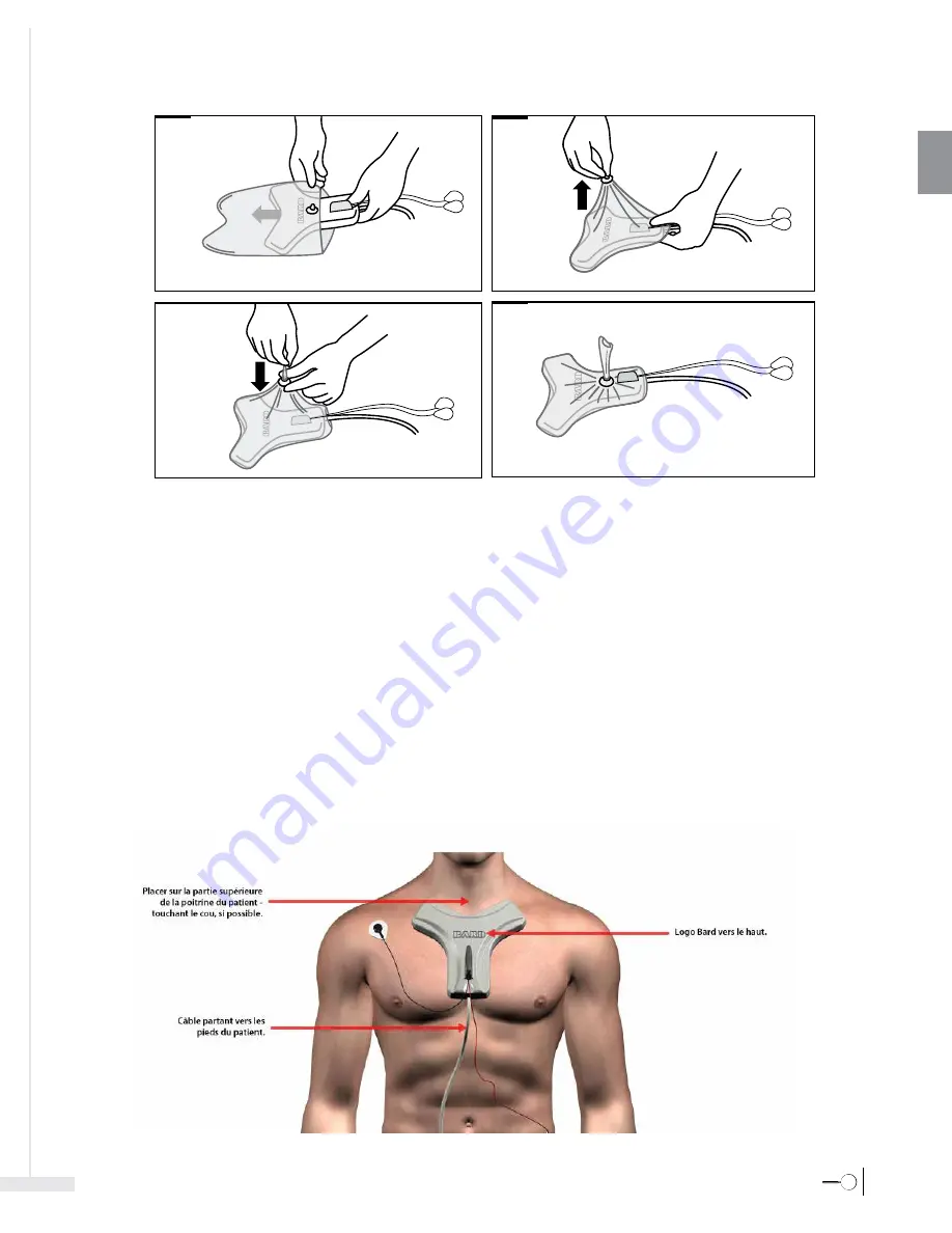 Bard Sherlock 3CG Instructions For Use Manual Download Page 45