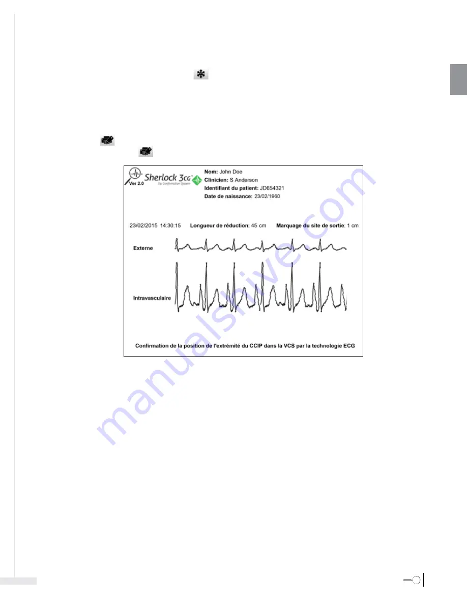 Bard Sherlock 3CG Instructions For Use Manual Download Page 47