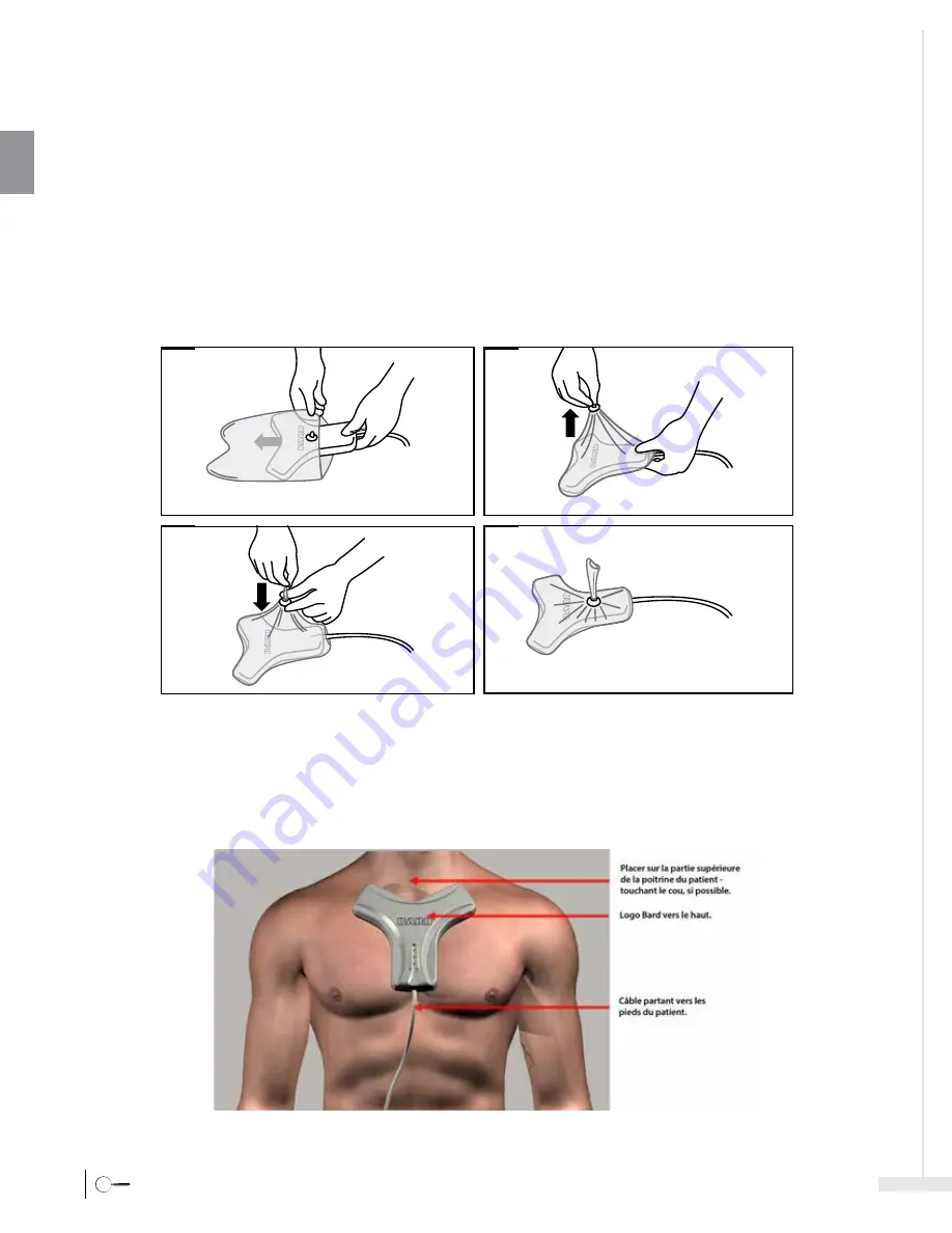 Bard Sherlock 3CG Instructions For Use Manual Download Page 48