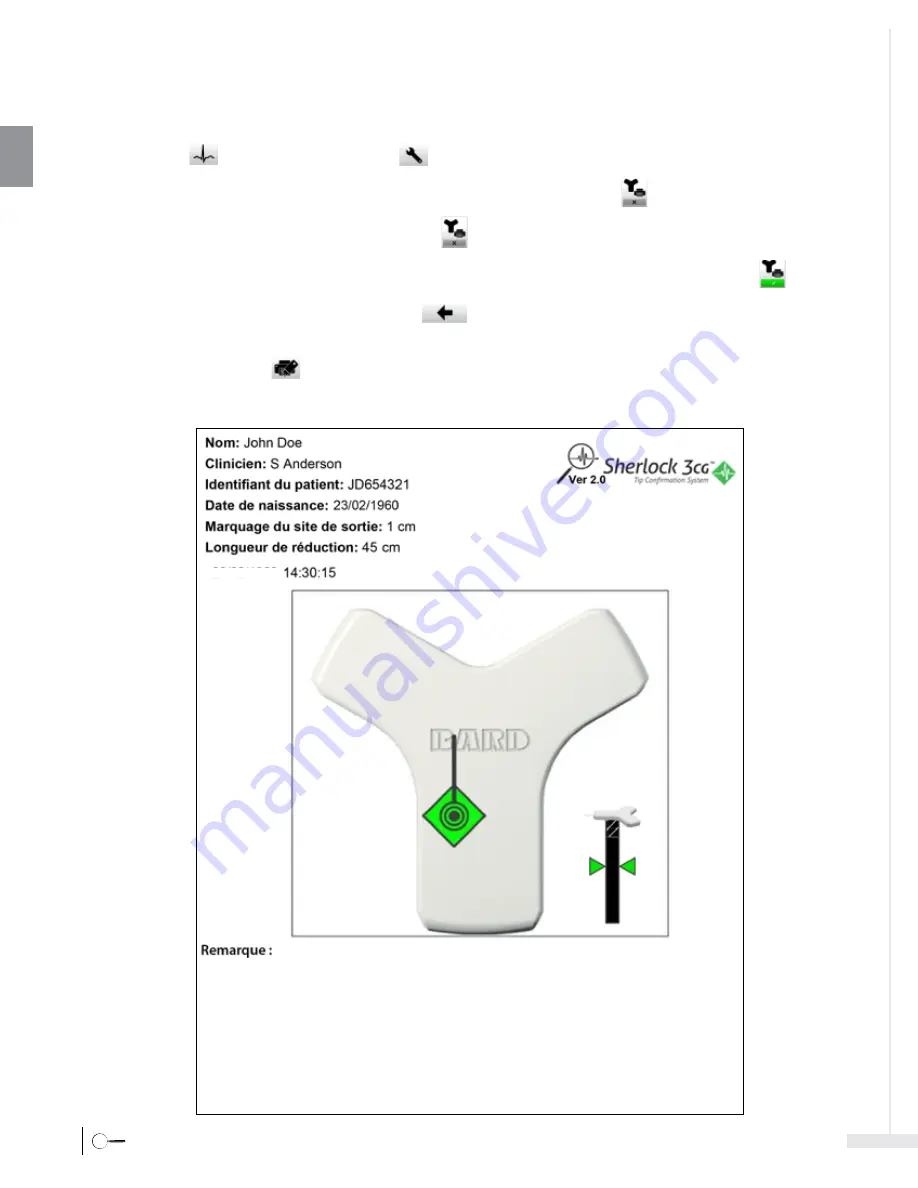 Bard Sherlock 3CG Instructions For Use Manual Download Page 54