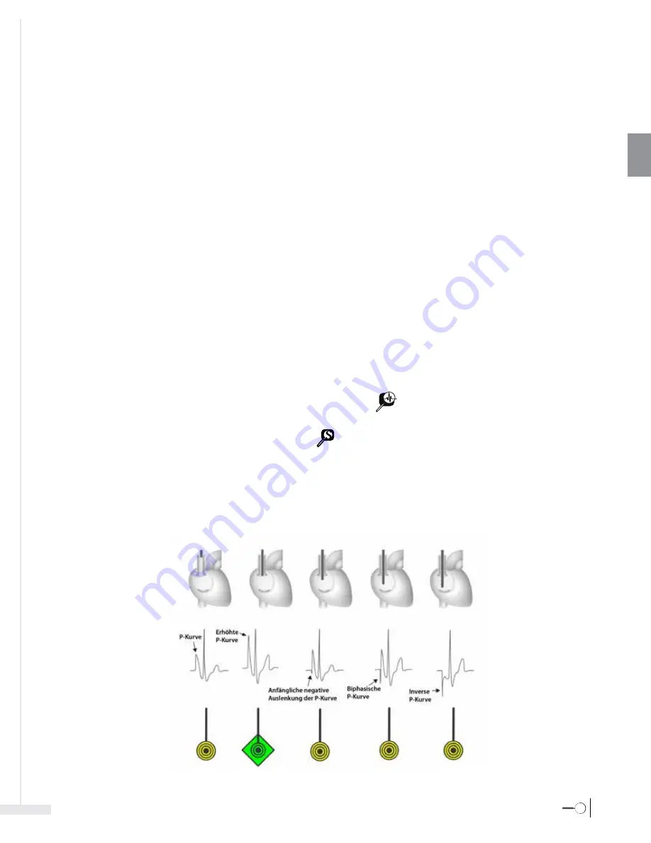 Bard Sherlock 3CG Instructions For Use Manual Download Page 61