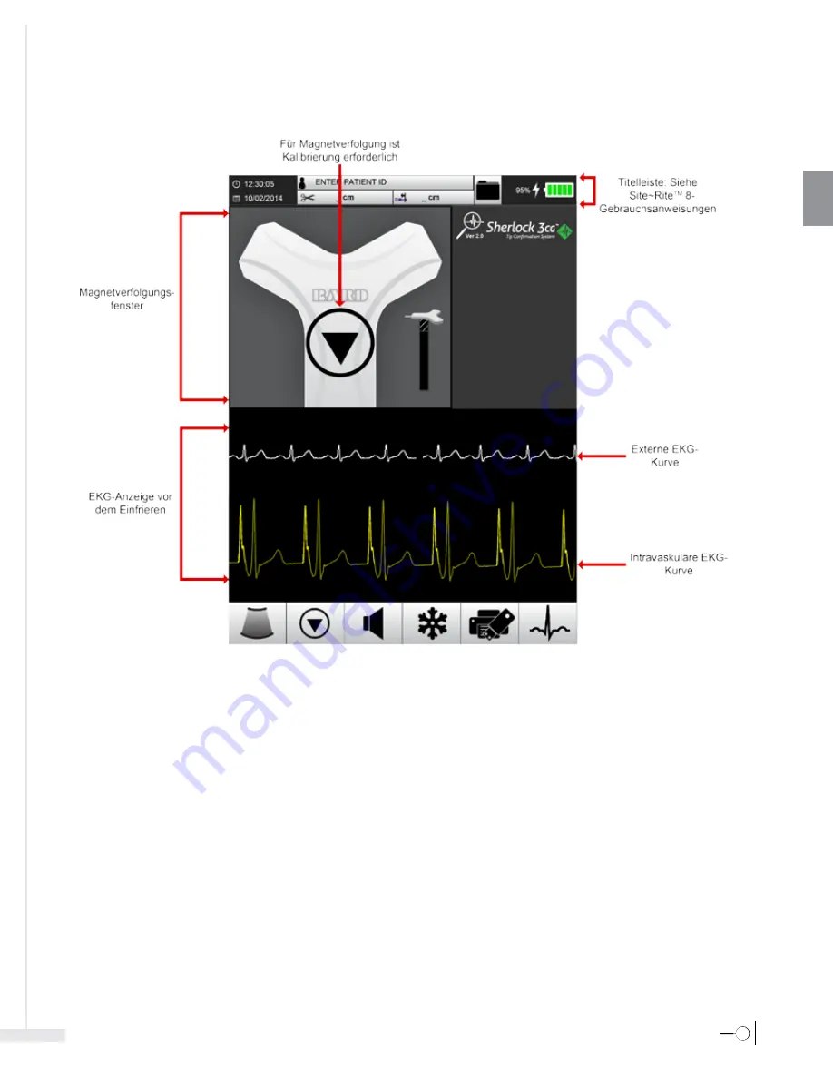 Bard Sherlock 3CG Instructions For Use Manual Download Page 65