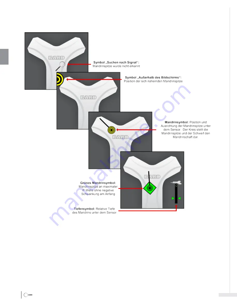 Bard Sherlock 3CG Instructions For Use Manual Download Page 66