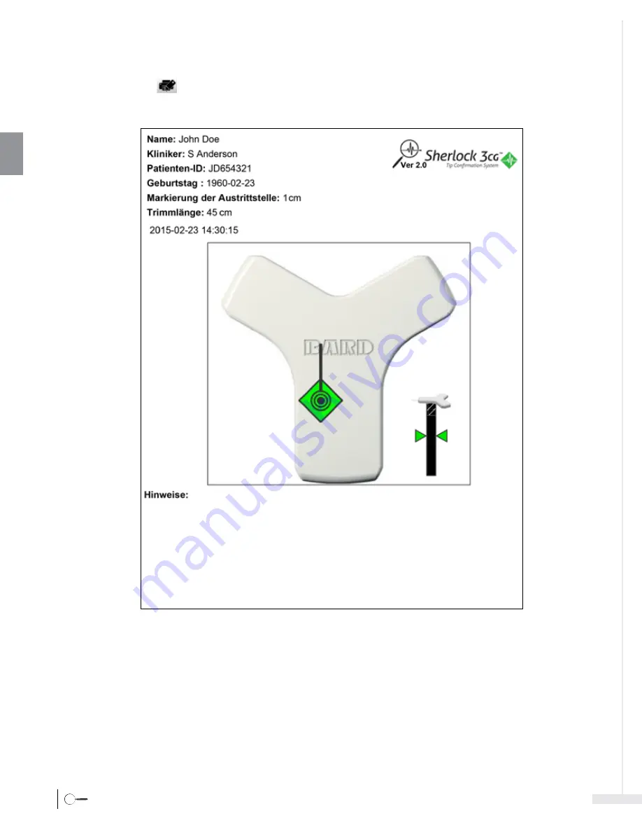 Bard Sherlock 3CG Instructions For Use Manual Download Page 82