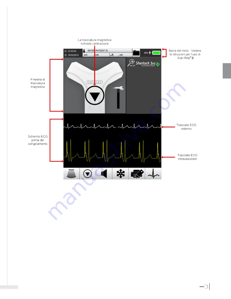 Bard Sherlock 3CG Instructions For Use Manual Download Page 93