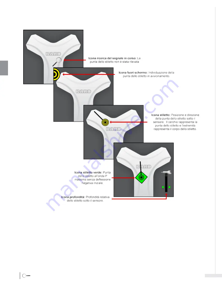 Bard Sherlock 3CG Instructions For Use Manual Download Page 94