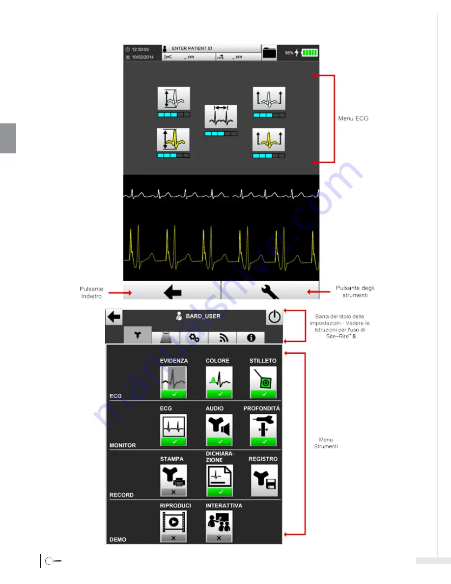 Bard Sherlock 3CG Instructions For Use Manual Download Page 96