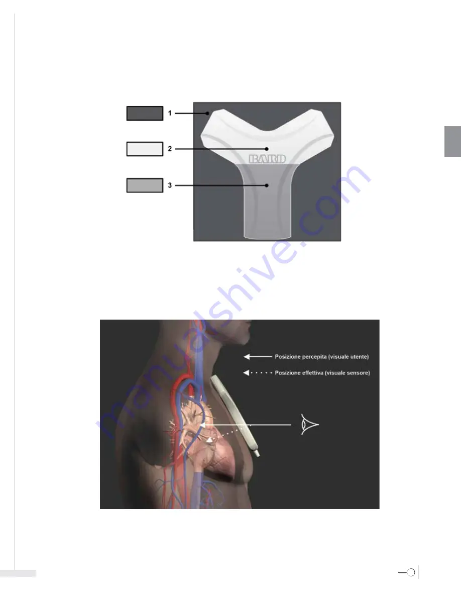 Bard Sherlock 3CG Instructions For Use Manual Download Page 99