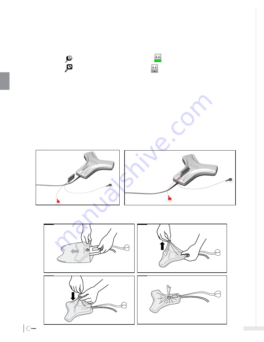 Bard Sherlock 3CG Instructions For Use Manual Download Page 100