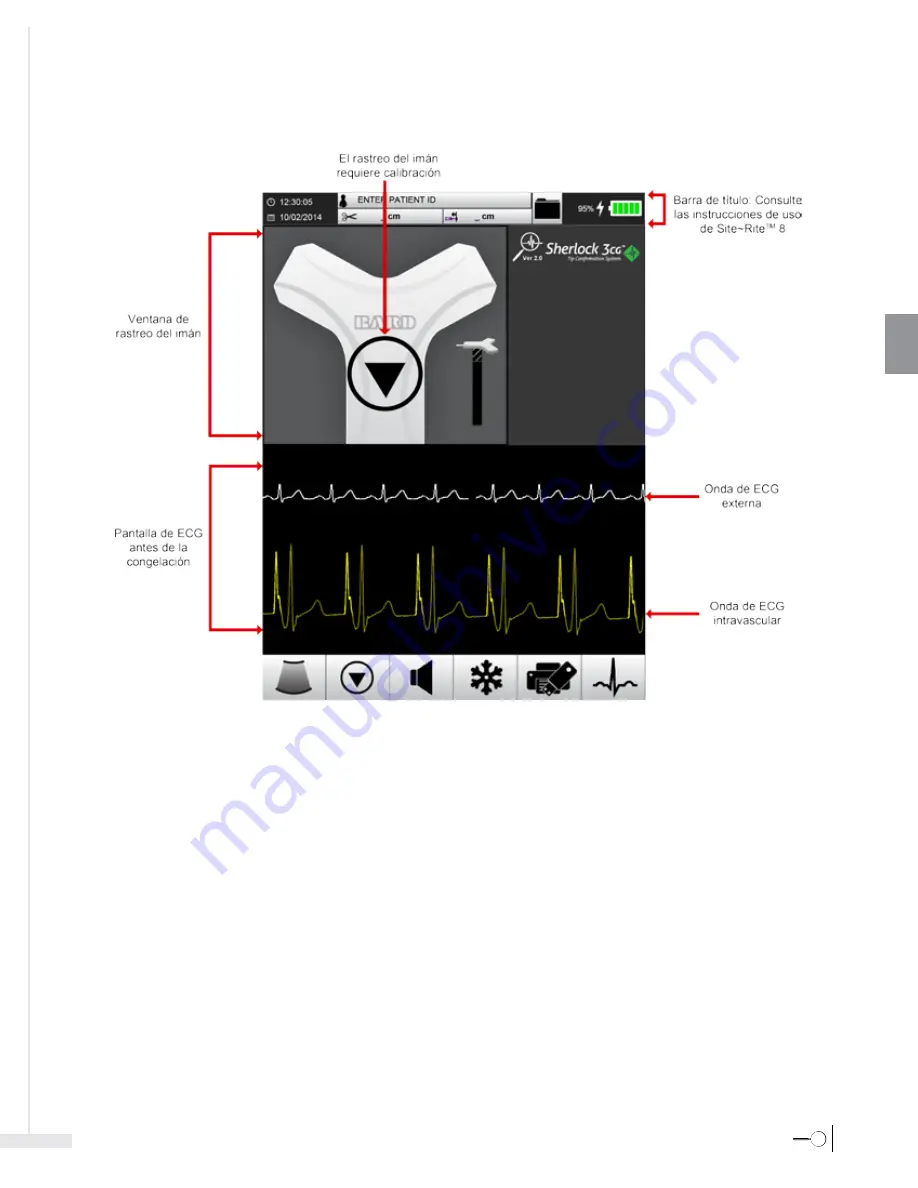 Bard Sherlock 3CG Instructions For Use Manual Download Page 119