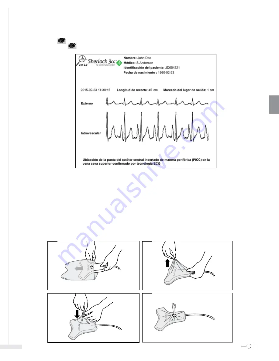 Bard Sherlock 3CG Instructions For Use Manual Download Page 129