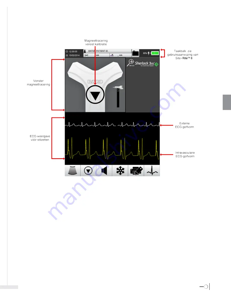 Bard Sherlock 3CG Instructions For Use Manual Download Page 145