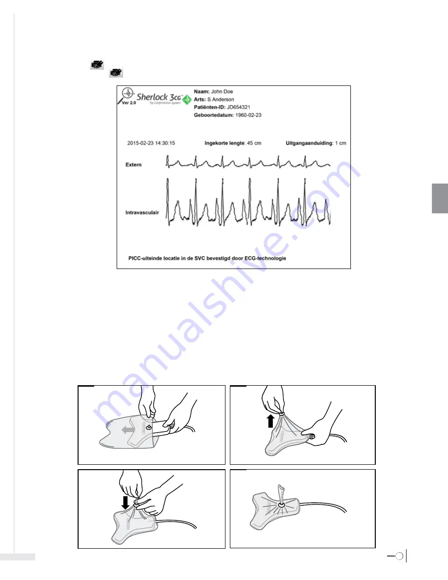 Bard Sherlock 3CG Instructions For Use Manual Download Page 155