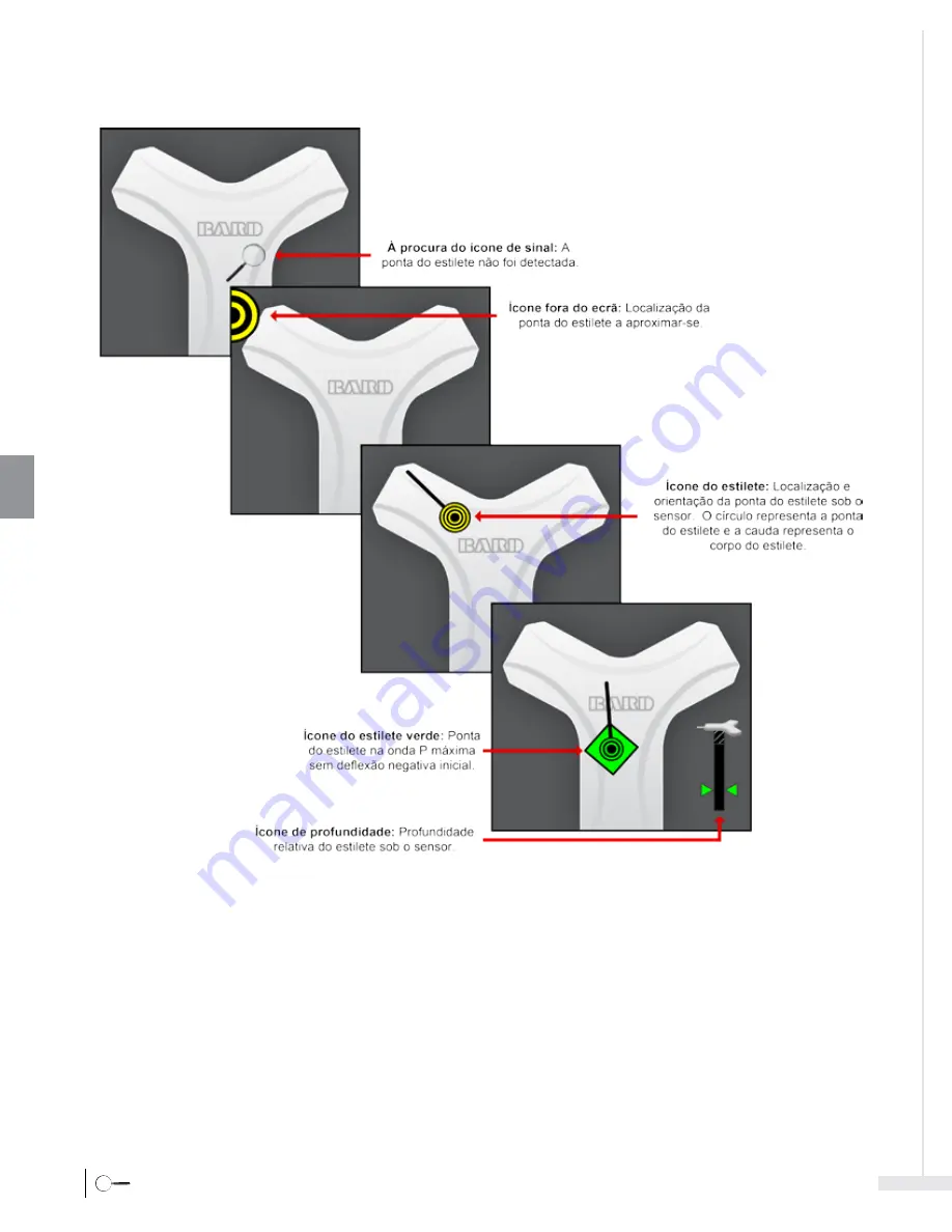 Bard Sherlock 3CG Instructions For Use Manual Download Page 172