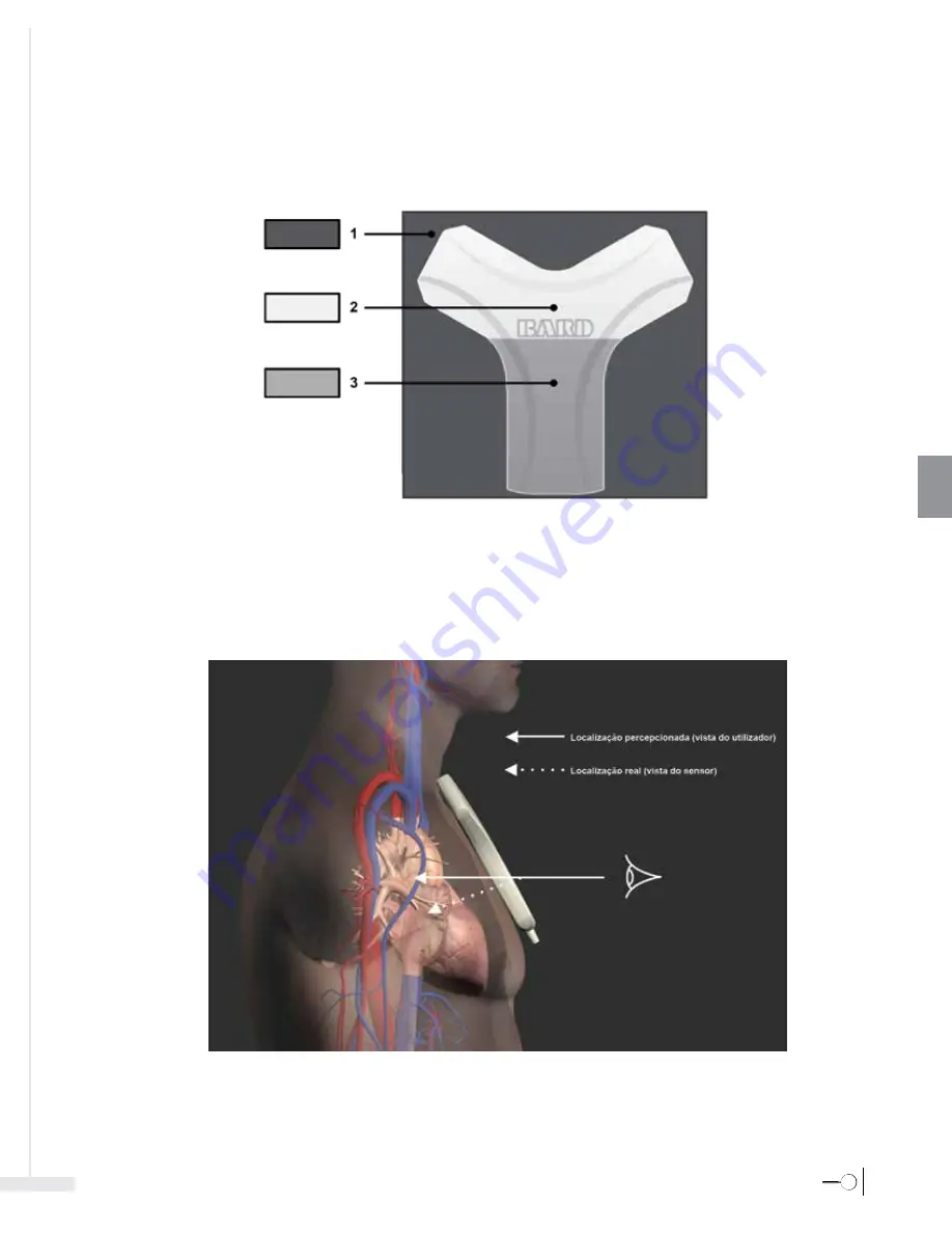 Bard Sherlock 3CG Instructions For Use Manual Download Page 177