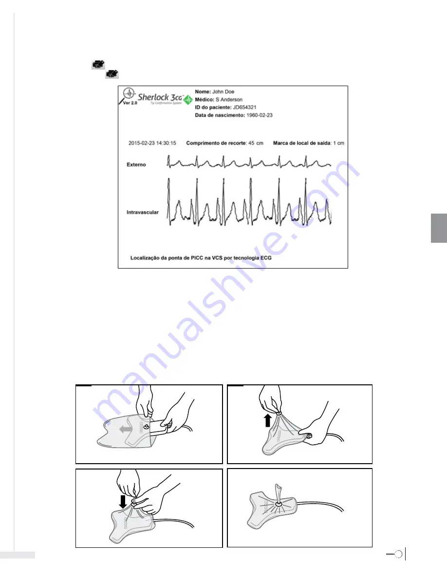 Bard Sherlock 3CG Instructions For Use Manual Download Page 181