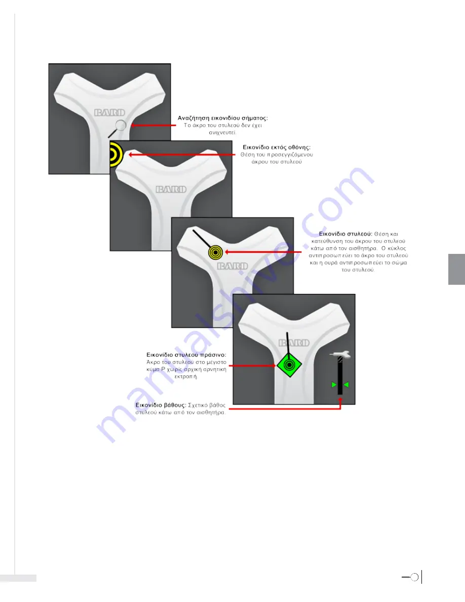 Bard Sherlock 3CG Instructions For Use Manual Download Page 201