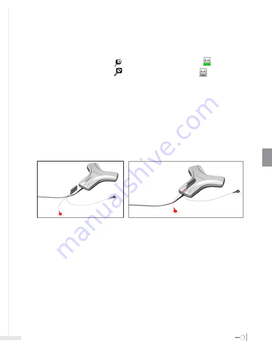 Bard Sherlock 3CG Instructions For Use Manual Download Page 207