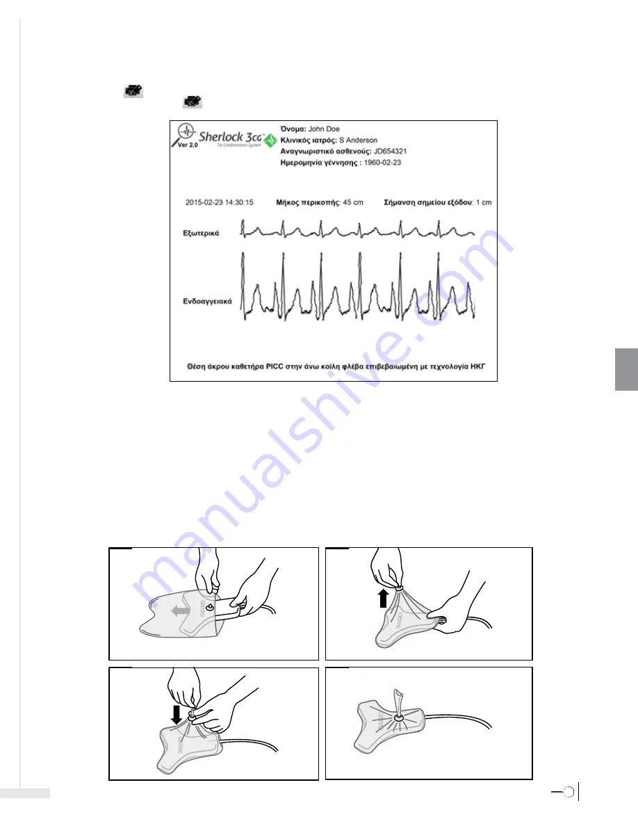 Bard Sherlock 3CG Instructions For Use Manual Download Page 211