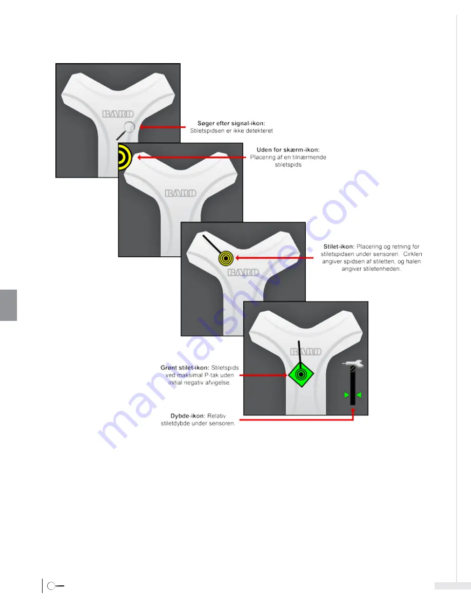 Bard Sherlock 3CG Instructions For Use Manual Download Page 230