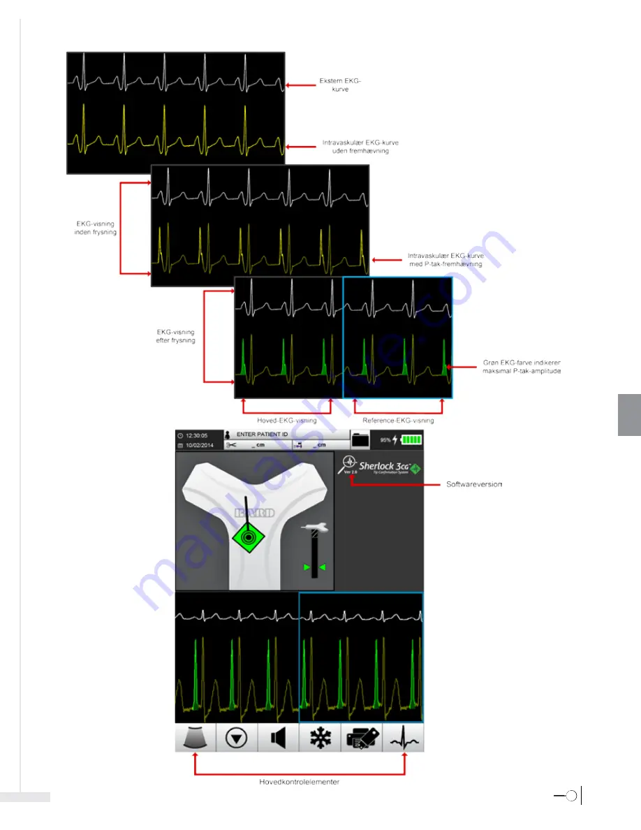 Bard Sherlock 3CG Instructions For Use Manual Download Page 231