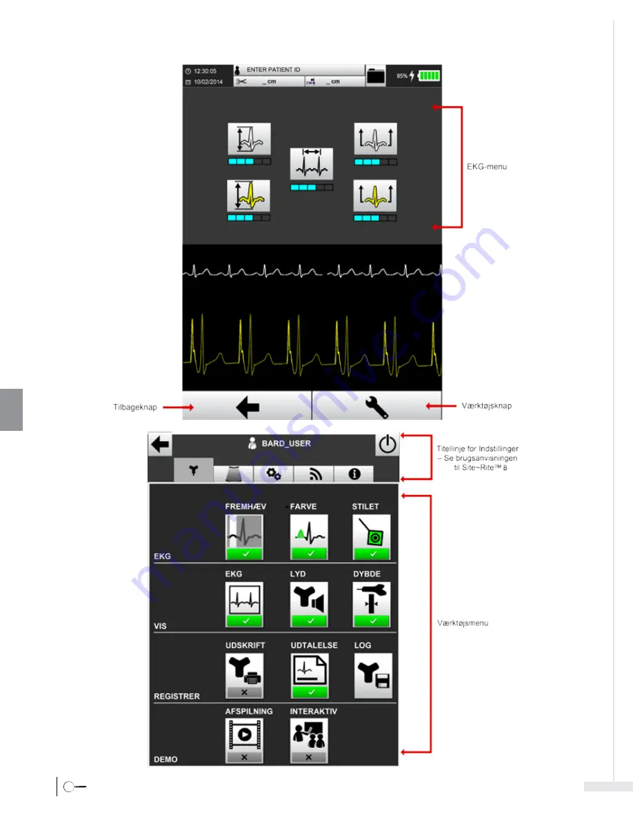 Bard Sherlock 3CG Instructions For Use Manual Download Page 232