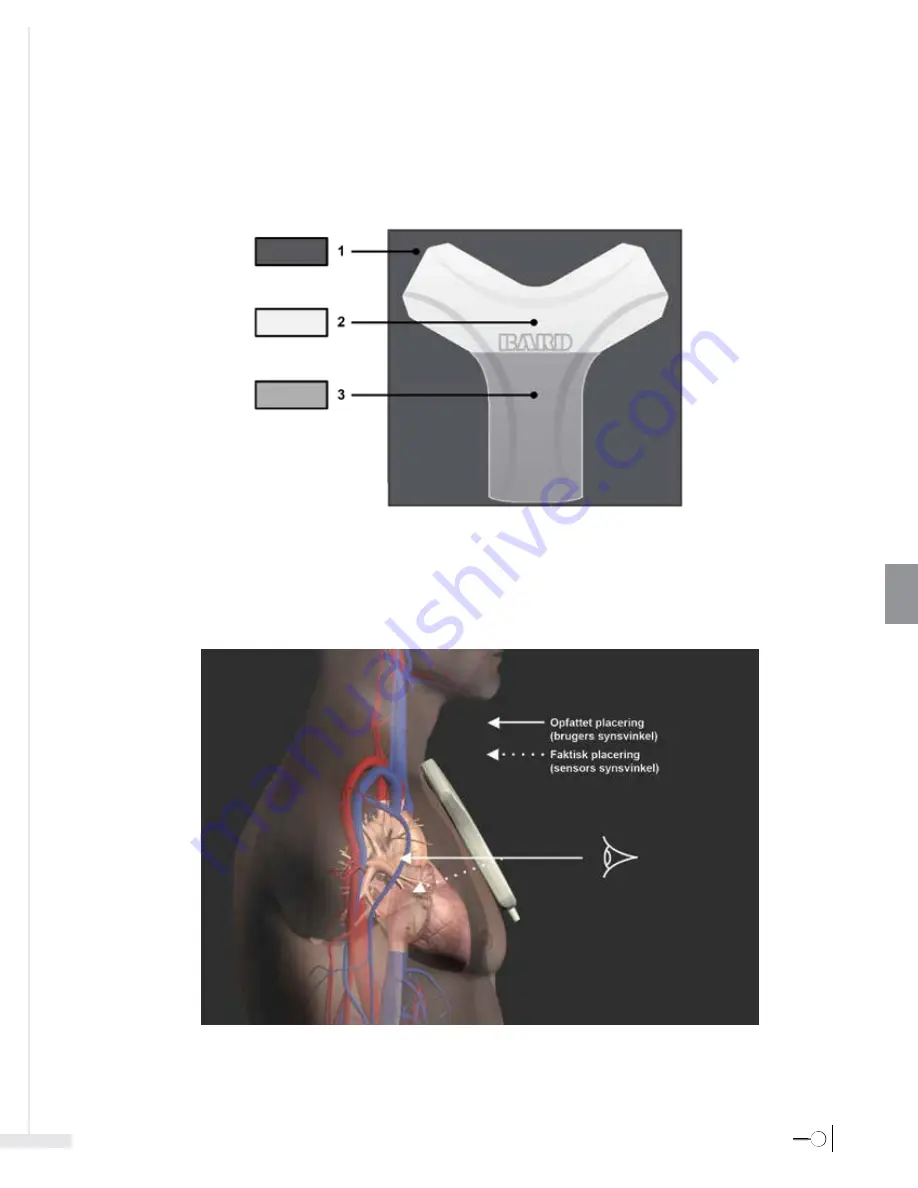 Bard Sherlock 3CG Instructions For Use Manual Download Page 235