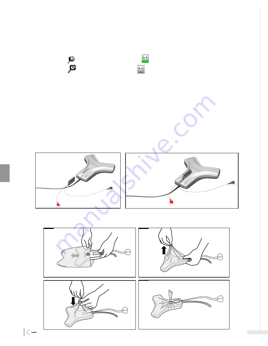 Bard Sherlock 3CG Instructions For Use Manual Download Page 236