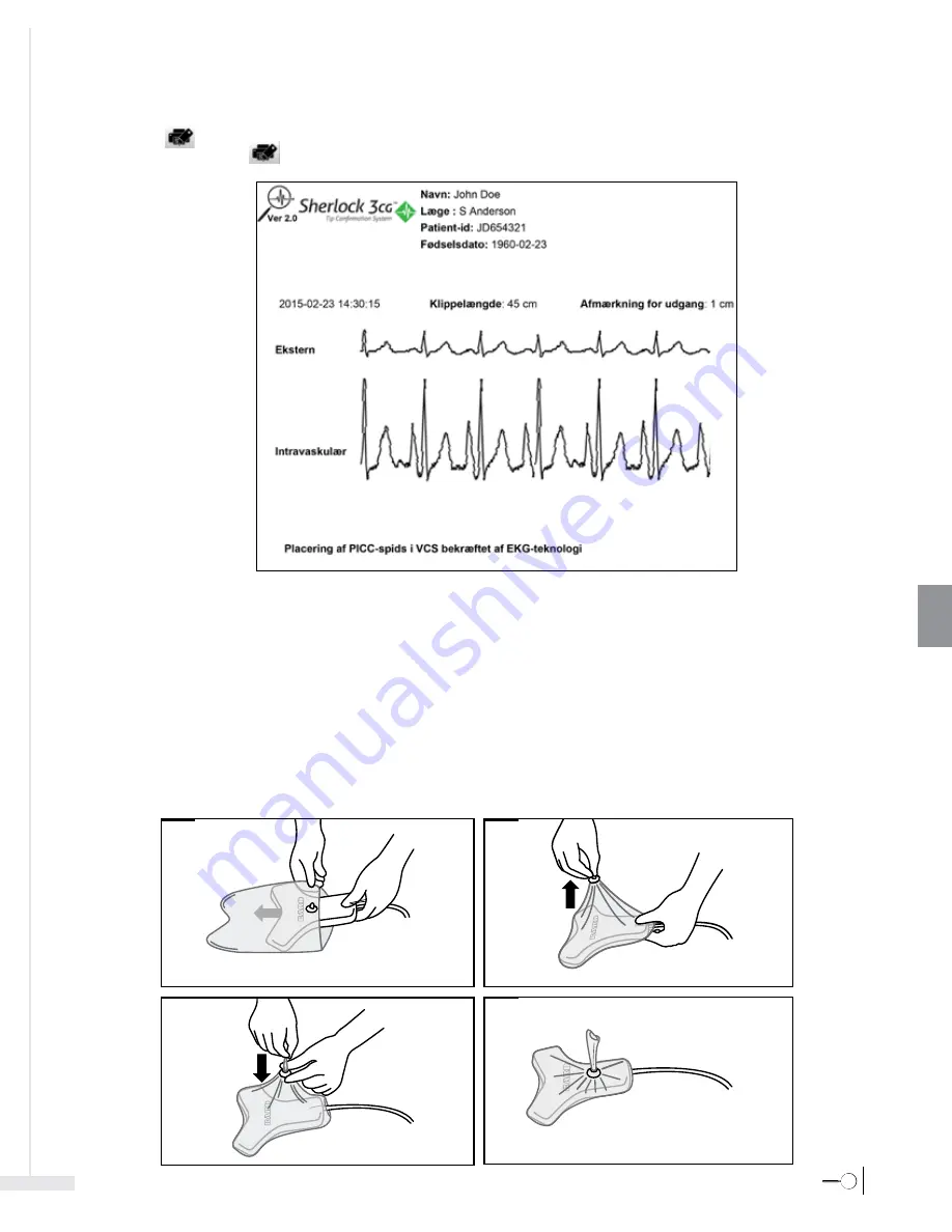 Bard Sherlock 3CG Instructions For Use Manual Download Page 239