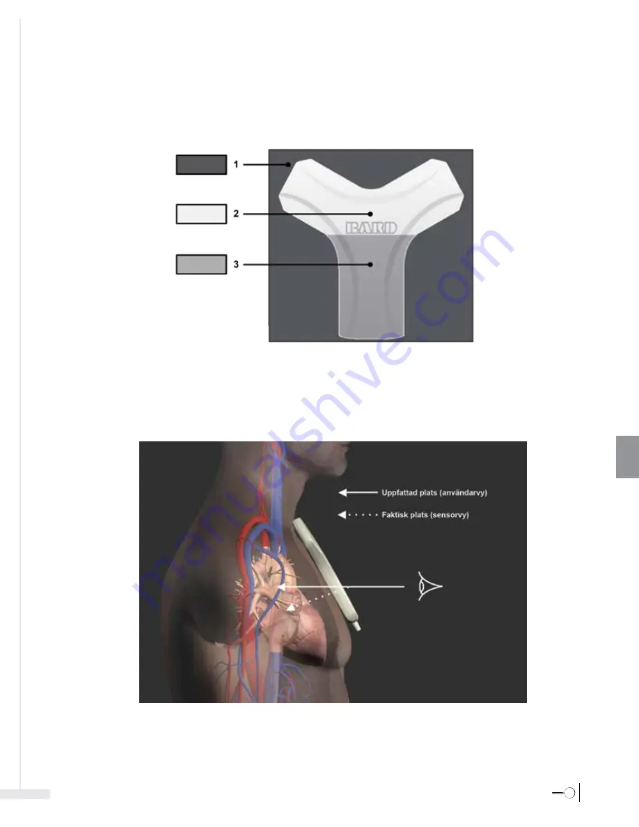 Bard Sherlock 3CG Instructions For Use Manual Download Page 261