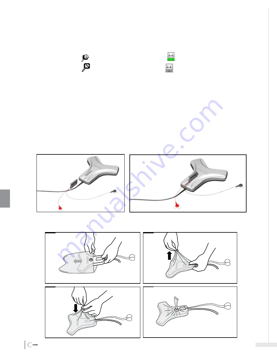 Bard Sherlock 3CG Instructions For Use Manual Download Page 262